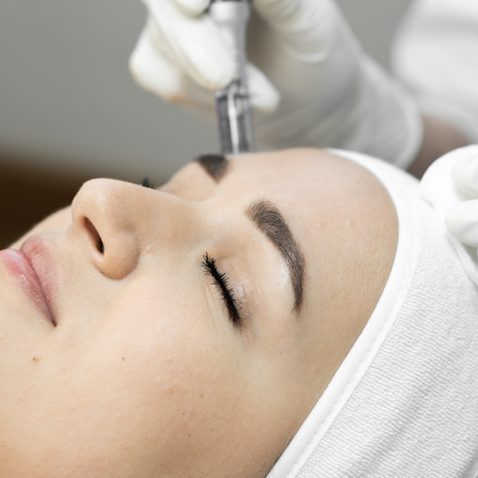 Microneedling: Everything you need to know